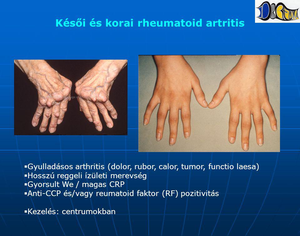 korai rheumatoid arthritis az ujjízület gyulladása